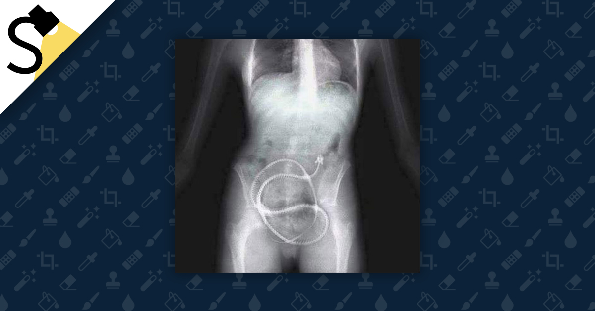 X ray insertion porn
