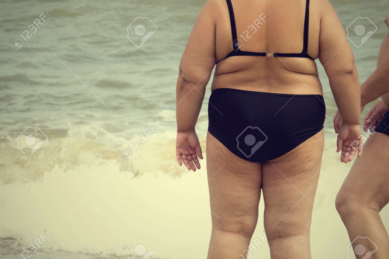 Fat cellulite bikini butts