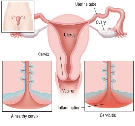 Itching inside vagina and troat