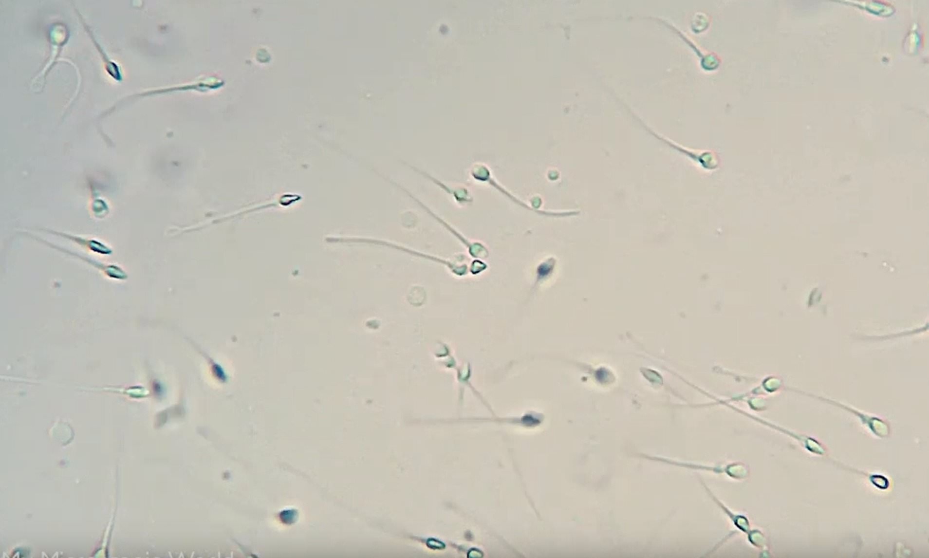 Sperm microscope count self
